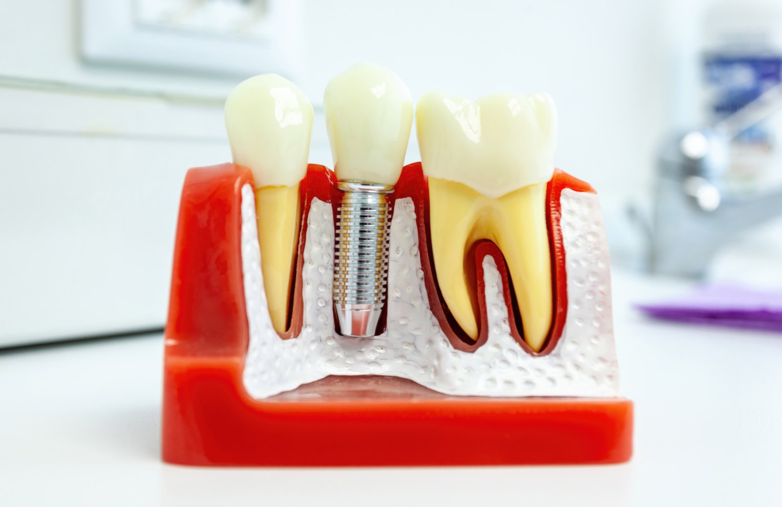 Cosmetic Dentistry