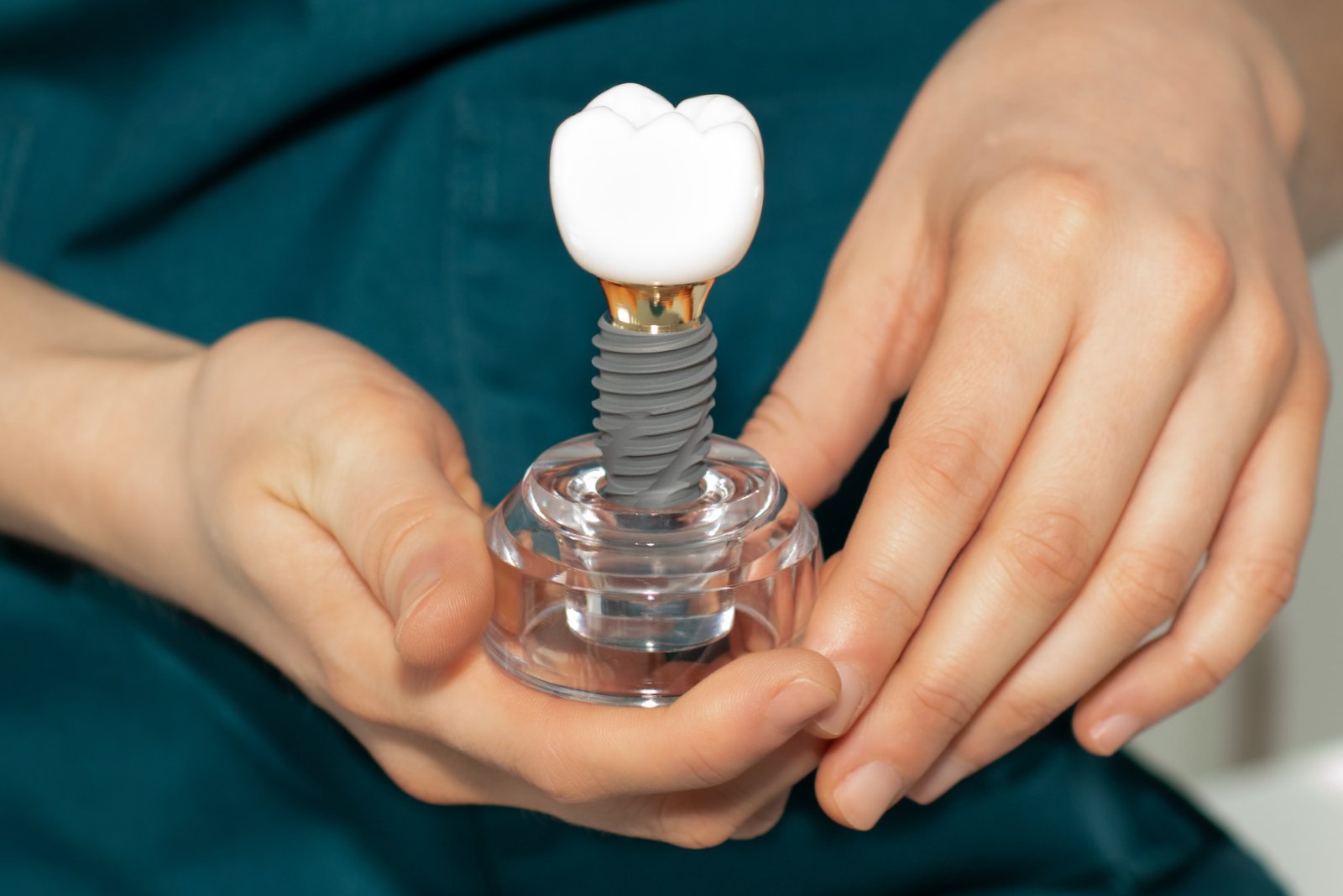 Dental Implant